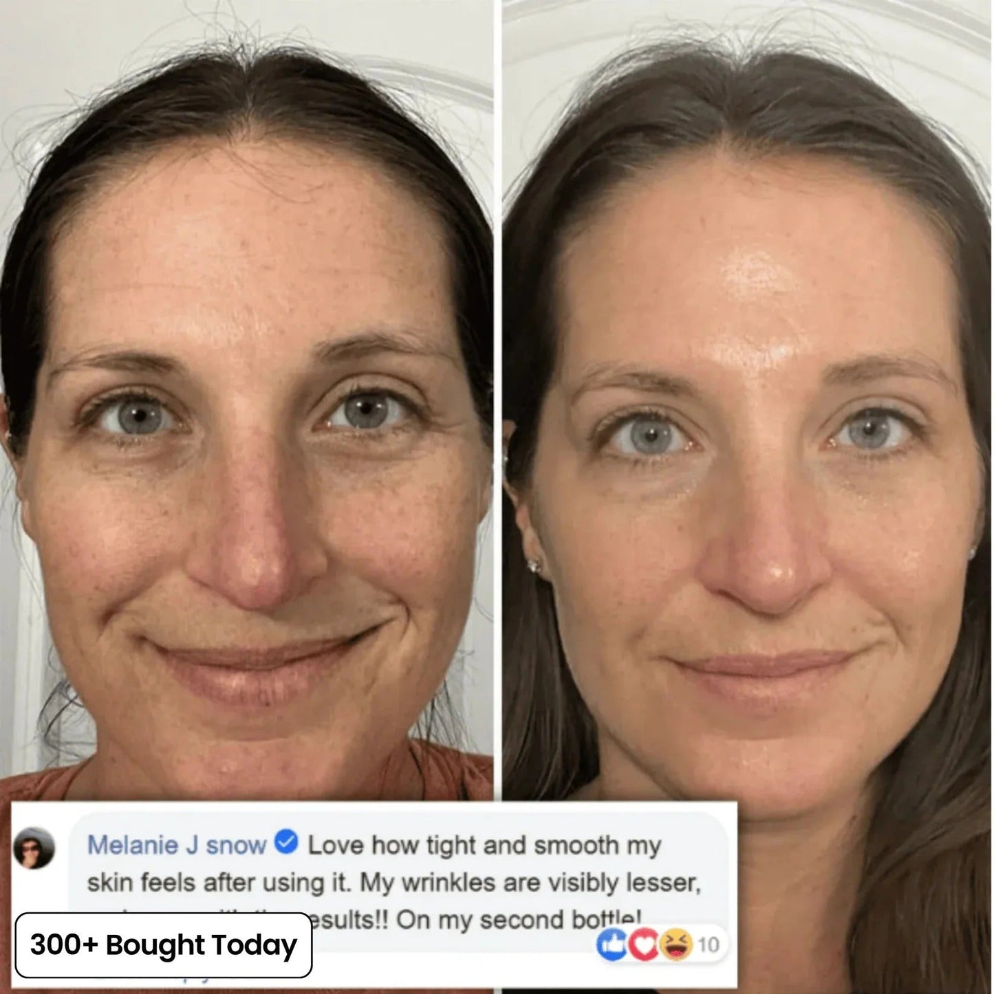 🔥LAST DAY 50% OFF!!Nexisify Wrinkle Collagen Moisture Balm