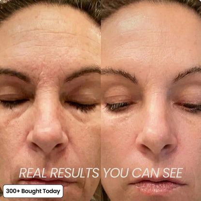 🔥LAST DAY 50% OFF!!Nexisify Wrinkle Collagen Moisture Balm