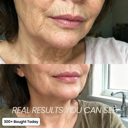 🔥LAST DAY 50% OFF!!Nexisify Wrinkle Collagen Moisture Balm