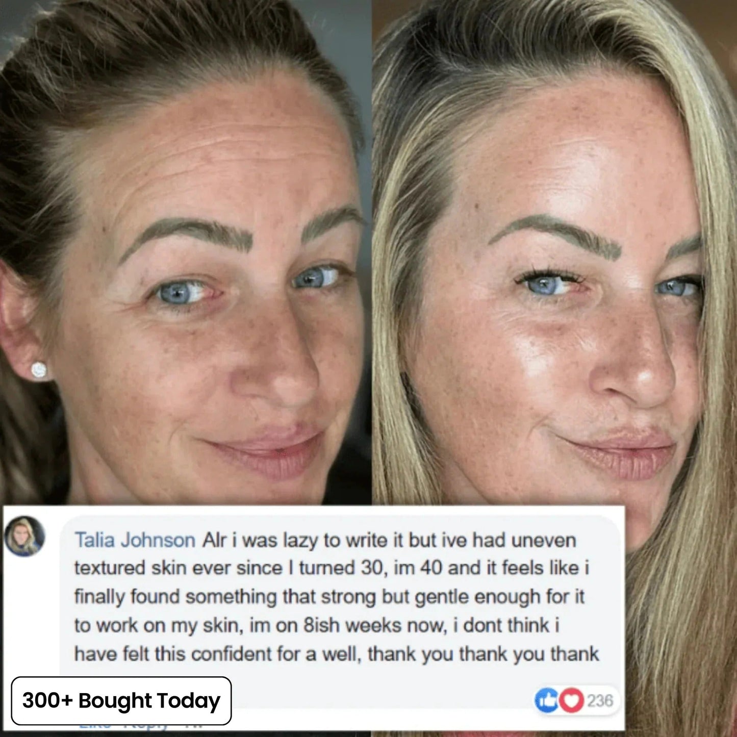 🔥LAST DAY 50% OFF!!Nexisify Wrinkle Collagen Moisture Balm
