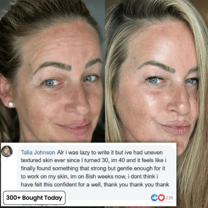 🔥LAST DAY 50% OFF!!Nexisify Wrinkle Collagen Moisture Balm
